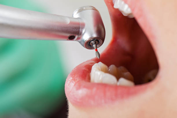 Best Pediatric Emergency Dentist in Granby, CO